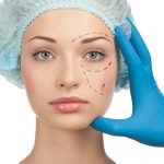 Plastic Surgery Procedures